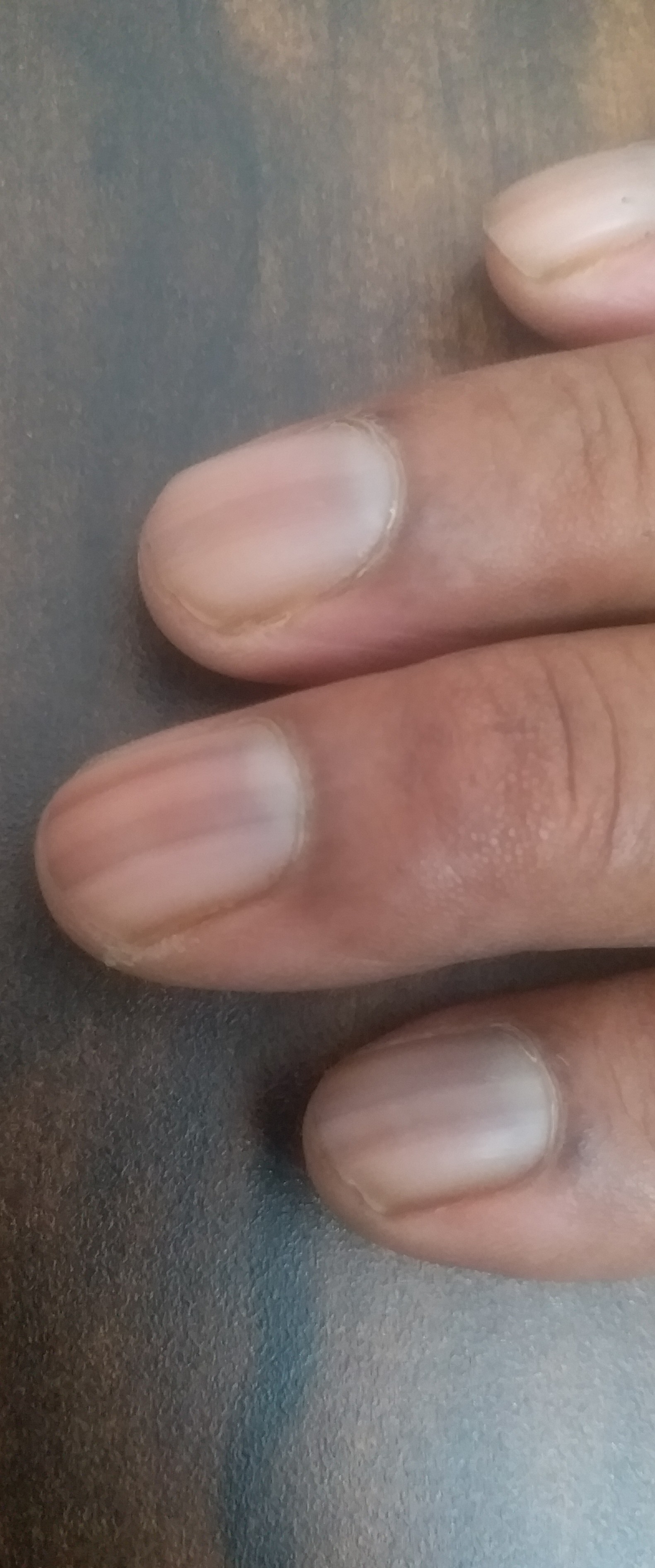 Quick Fix:  Treating Brown Discoloration In Dog Nails - 826px82