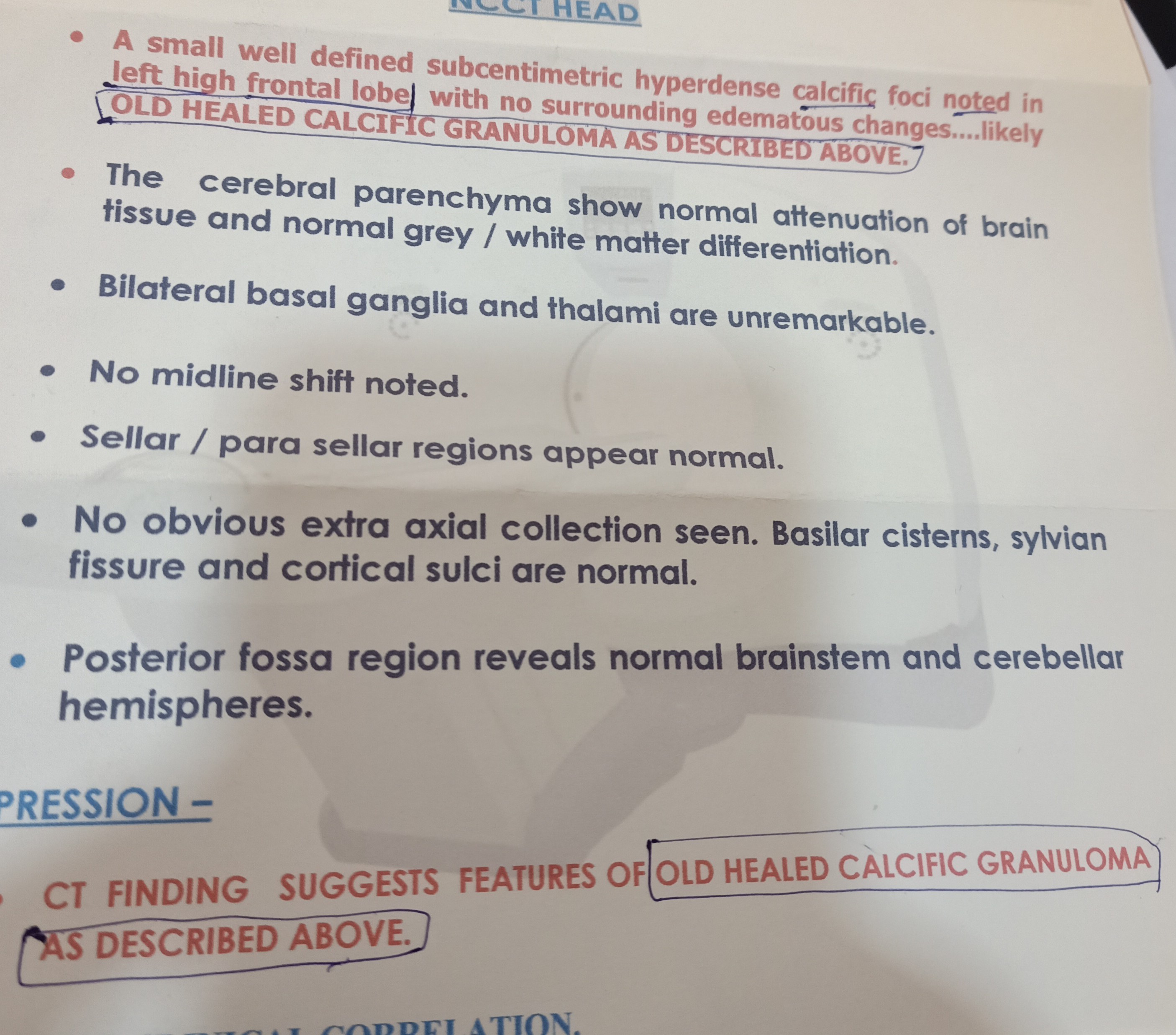brain-granuloma